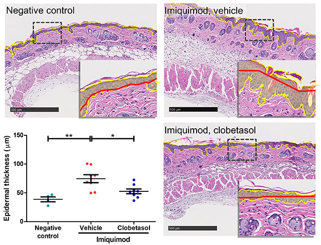 Epidermal thickening - H&E stained skin sections and calculated epidermal thickness)